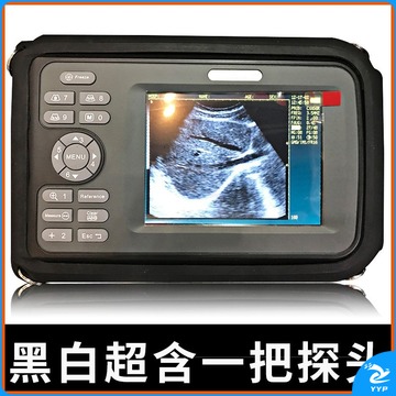 远燕/YUAN YAN b超机人用便携式彩色黑白超掌上孕妇看男女高清检孕仪孕诊断 XF30 笔记本型+腹部探头 安全用仪器